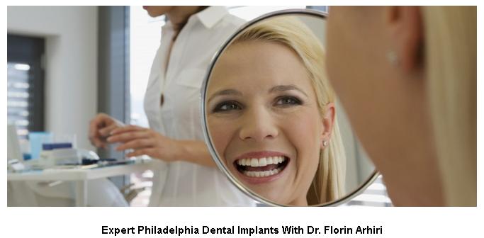 Philadelphia dental implants