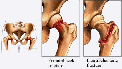 What Traits Make A Good Orthopedic Surgeon