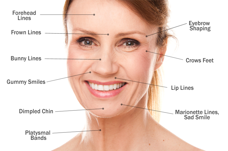 Slimming Down Your Face Using Botox