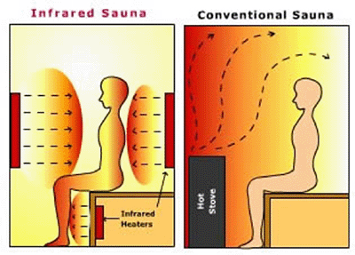 Things To Know While Selecting Infra-Red Saunas