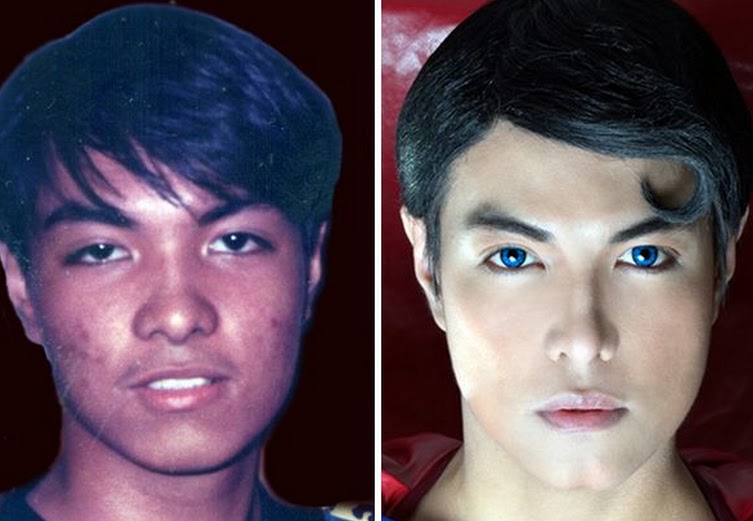 Man Gets Plastic Surgery To Look Like Superman