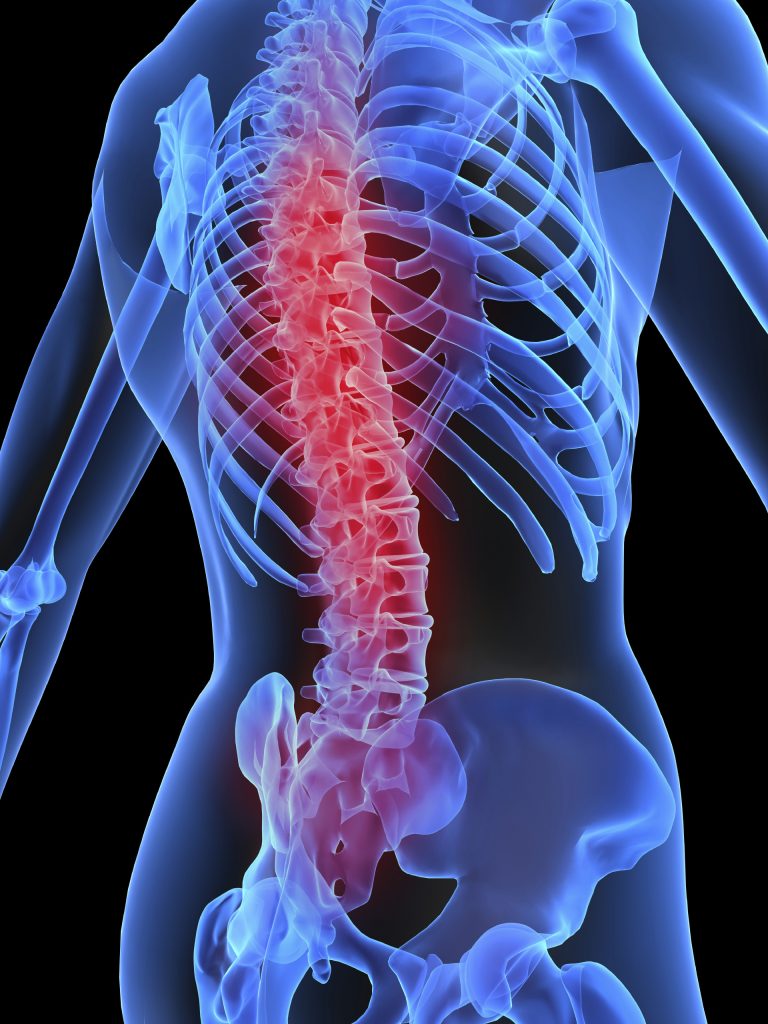 Advances In Spinal Cord Injury Treatment
