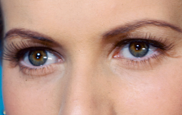 Common Health Problems Associated With The Eyes That You Might Not Be Aware Of