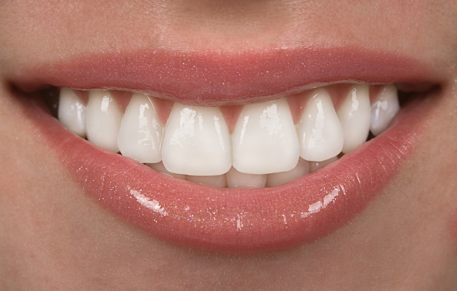 Understanding Porcelain Dental Veneers