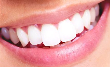 What To Do Before and After Your Teeth Whitened?