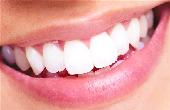 What To Do Before and After Your Teeth Whitened?