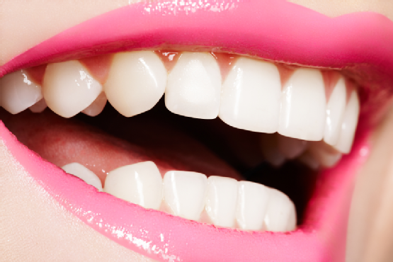 5 Tips For Maintaining A White, Healthy Smile