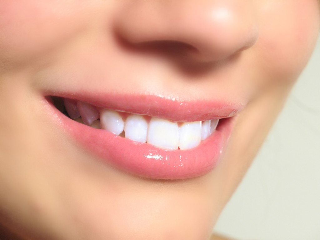What You Need To Know Before Getting Your Teeth Whitened