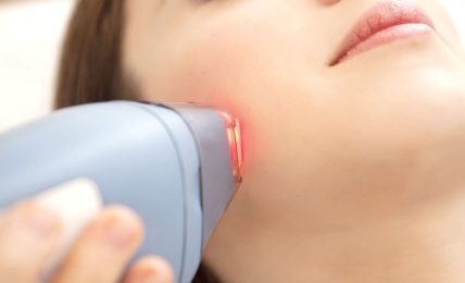 What Does Laser Hair Removal Cost?