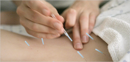 Acupuncture Therapy For Cancer Patients