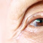 Getting Your Eyesight Back After Cataracts