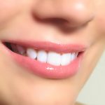 Teeth Whitening Guide