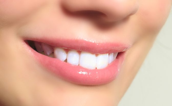 Teeth Whitening Guide