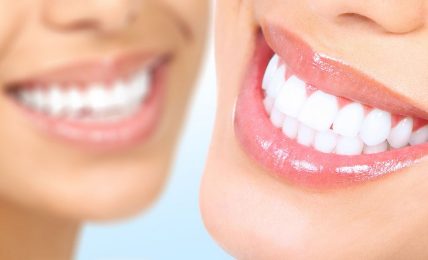 Smile Makeovers: Why You Should Be Considering Cosmetic Dentistry