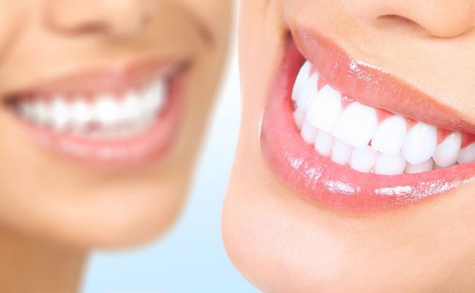 Smile Makeovers: Why You Should Be Considering Cosmetic Dentistry