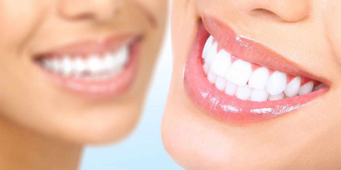 Smile Makeovers: Why You Should Be Considering Cosmetic Dentistry