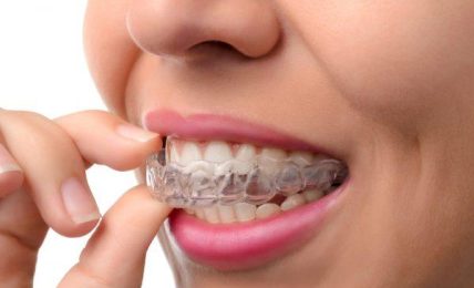 4 Advantages Of Teeth Straightening