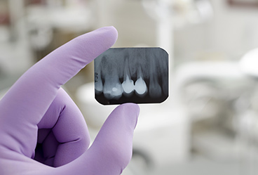 How Safe Are Dental X-Rays?