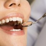 Why You Need To Get Your Teeth Checked Regularly