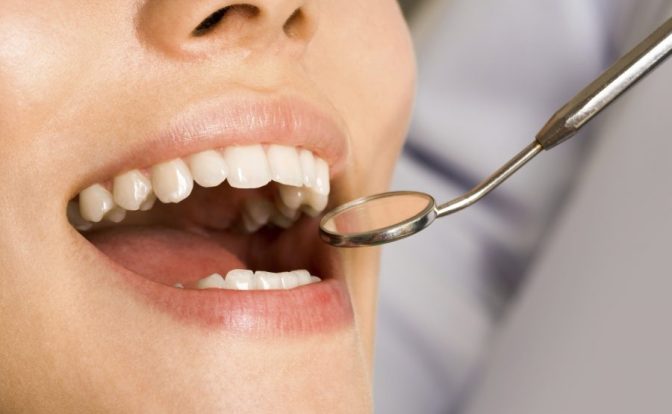 Why You Need To Get Your Teeth Checked Regularly