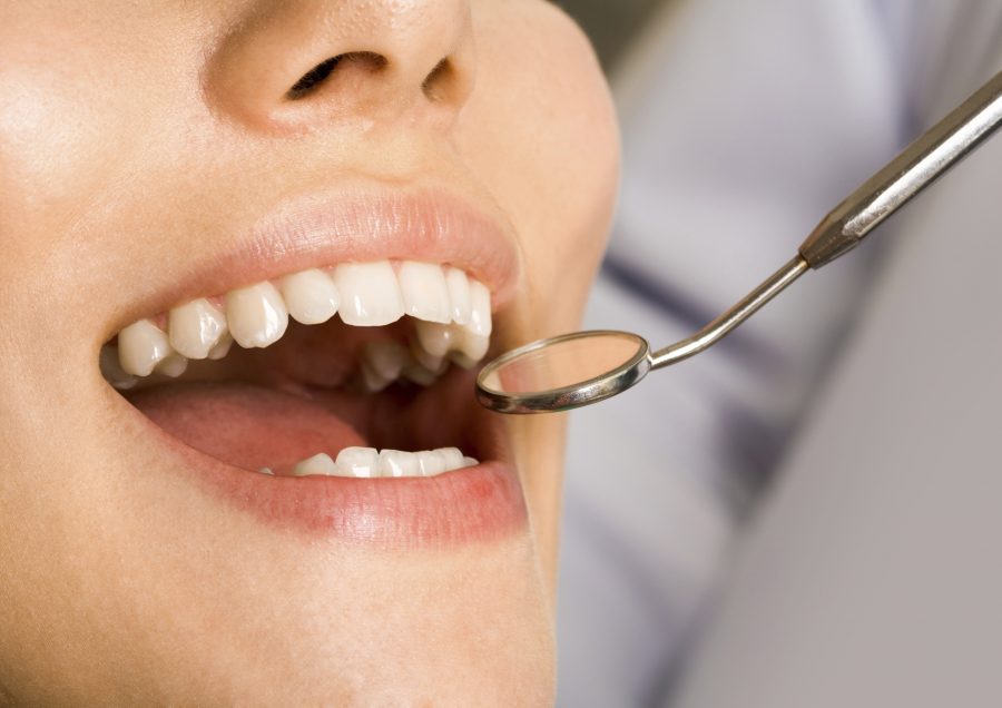 Why You Need To Get Your Teeth Checked Regularly