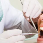 What Happens During A Dental Checkup?