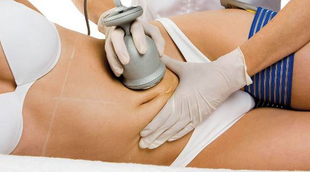 Get Perfect Contoured Body With Smart Laser Liposuction Treatment