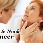 Head and Neck Cancers – Causes, Symptoms, Diagnosis and Treatment
