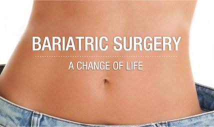 Concise Guide About Bariatric Surgery