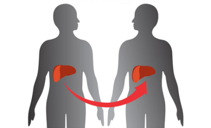 A Definite Guide Of Helping Your Loved Ones Recovering From Liver Transplant