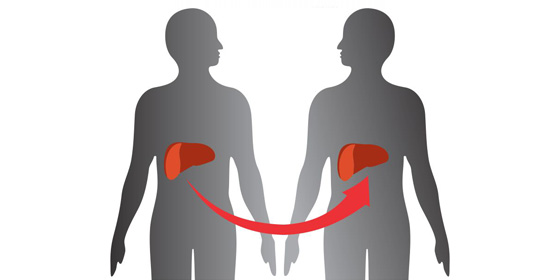 A Definite Guide Of Helping Your Loved Ones Recovering From Liver Transplant