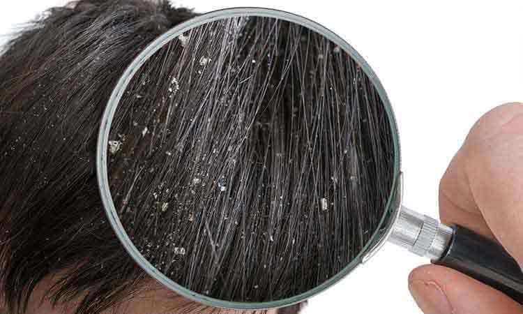hair care tips for dry hair in winters